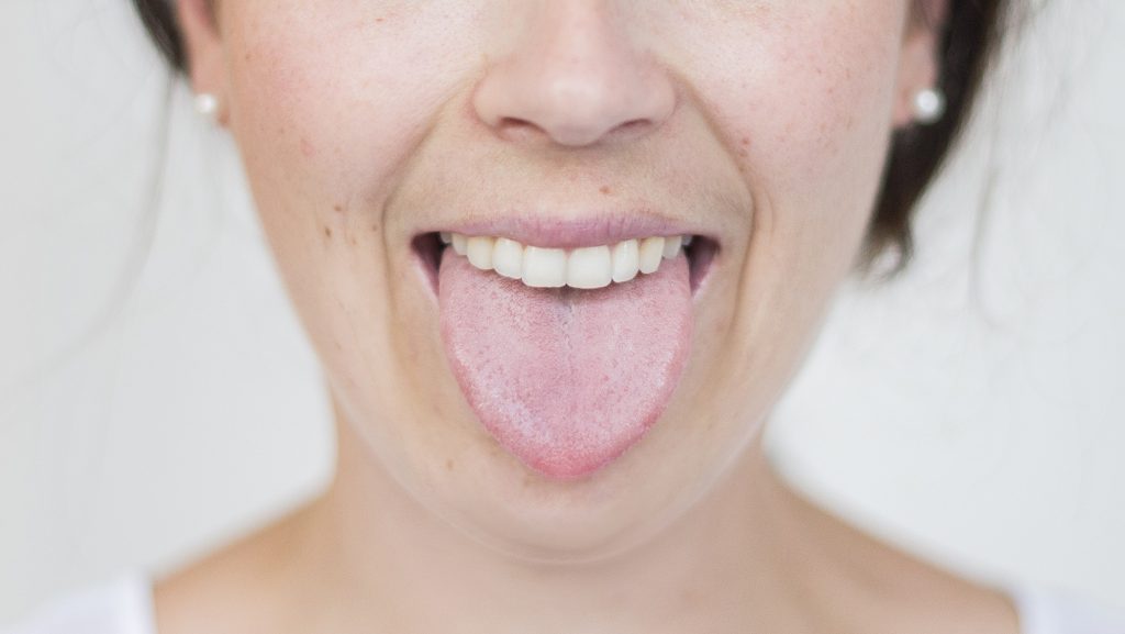 Eine Frau zeigt ihr Zunge um eine Zungendiagnostik durchzuführen