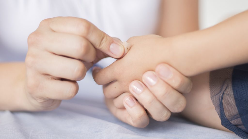 Dr. Schönhart klebt ein Goldkügelchen auf eine Kinderhand auf um einen Akupunkturpunkt schmerzfrei zu stimulieren.