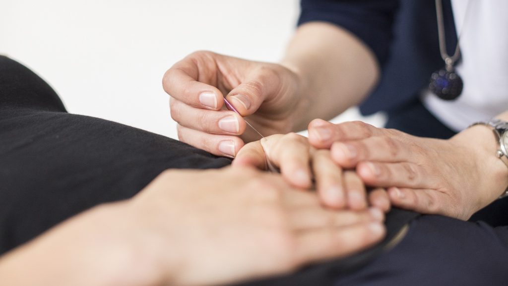 Körperakupunktur bei einer Frau wird durchgeführt. Frau Dr. Schönhart setzt eine Nadel auf die Hand.