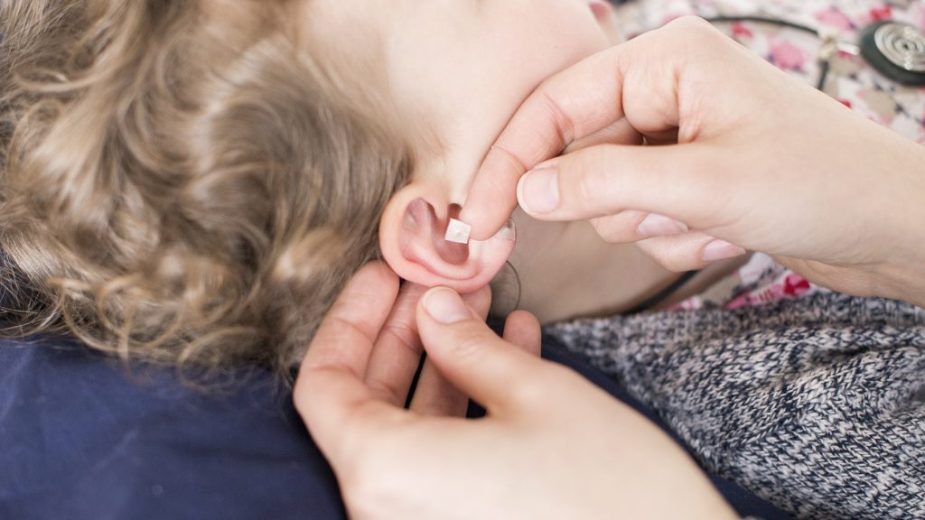 Samenkügelchen werden aud Ohrläppchen von einem Kind angebracht